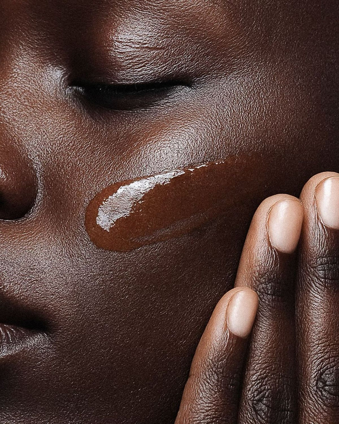 Managing Eczema in Spring: A Natural, Vegan Solution